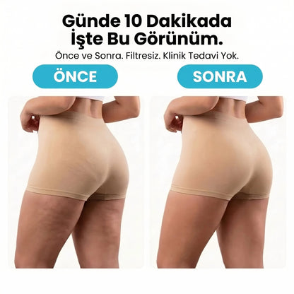 ZAEN™ Chirp™ | Evde Selülit Masajı – Pürüzsüz & Sıkı Görünüm - ZAEN®